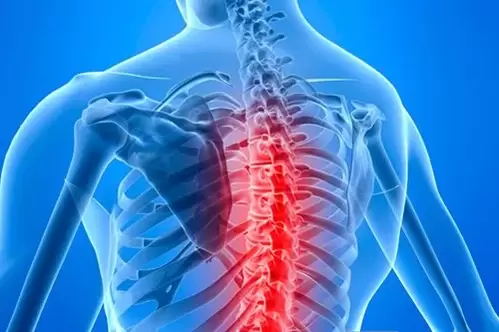 Diseases of the thoracic spine