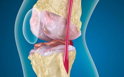 Causes of joint development of knee joints